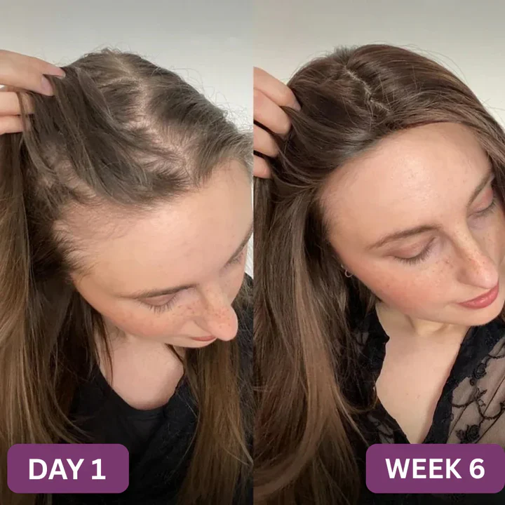 Veromy® Hair Growth Accelerator