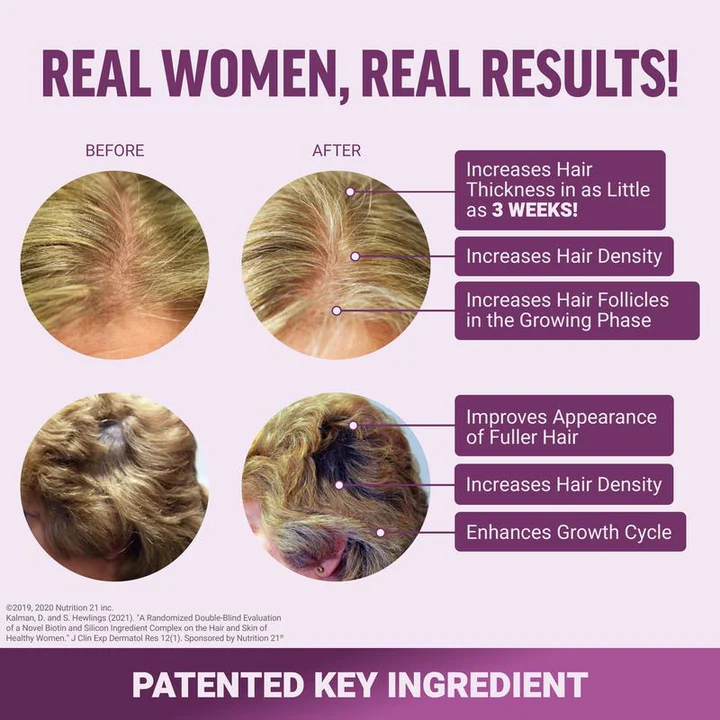 Veromy® Hair Growth Accelerator
